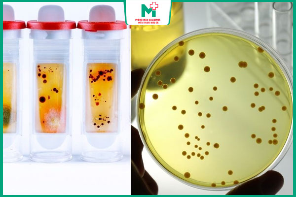 ý nghĩa kết quả rpr