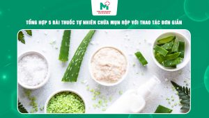 bài thuốc tự nhiên chữa mụn rộp