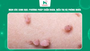 Mụn cóc sinh dục
