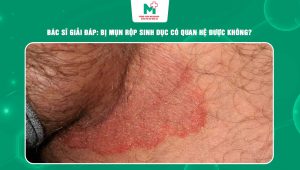 bị mụn rộp sinh dục có quan hệ được không