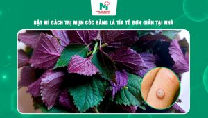 cách trị mụn cóc bằng lá tía tô