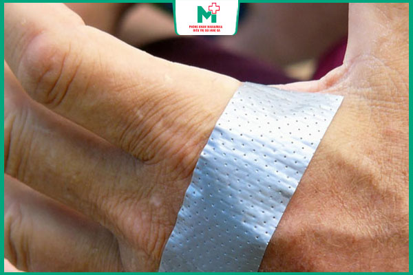 dán băng keo làm mềm nốt mụn