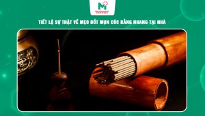 đốt mụn cóc bằng nhang