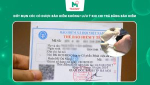 đốt mụn cóc có được bảo hiểm