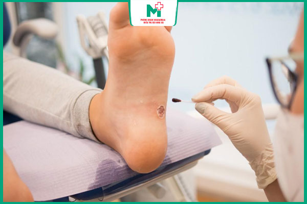 gặp bác sĩ sớm