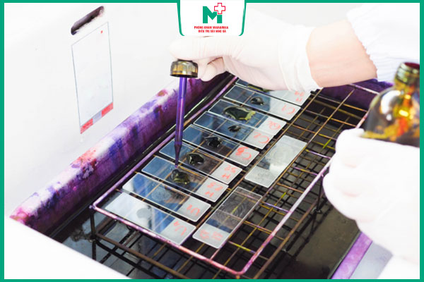 giá xét nghiệm lậu