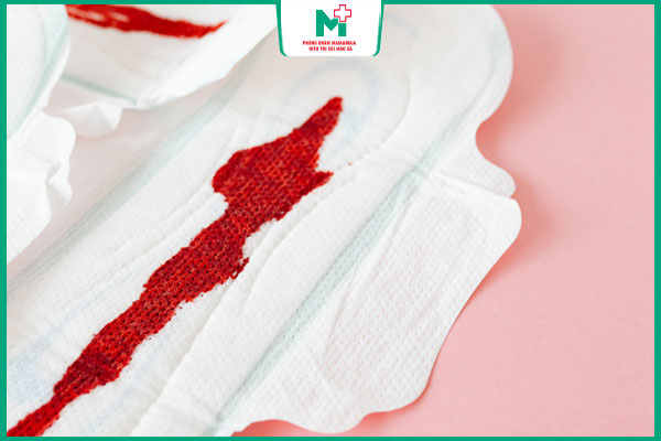 mẹo dân gian dùng máu kinh xóa mụn cóc