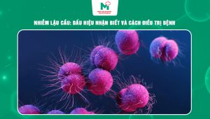 nhiễm lậu cầu