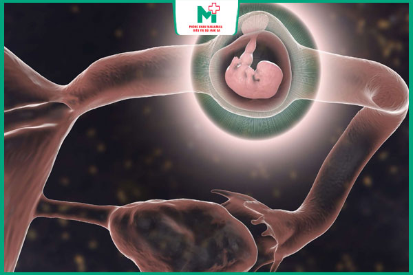 thai ngoài tử cung