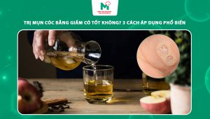 trị mụn cóc bằng giấm