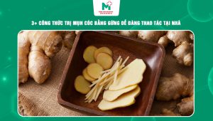 trị mụn cóc bằng gừng