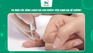 trị mụn cóc bằng laser giá bao nhiêu