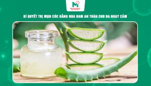 trị mụn cóc bằng nha đam