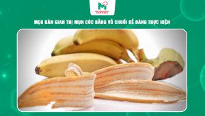trị mụn cóc bằng vỏ chuối