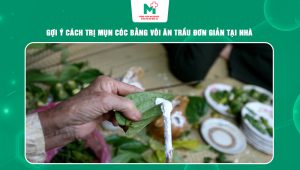 trị mụn cóc bằng vôi ăn trầu