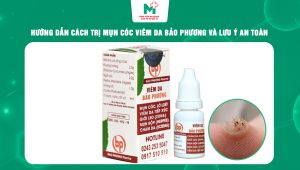 trị mụn cóc viêm da bảo phương