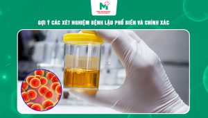xét nghiệm bệnh lậu