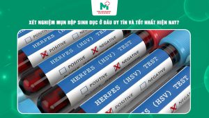 xét nghiệm mụn rộp sinh dục