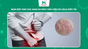 mụn rộp sinh dục nam