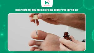 thuốc trị mụn cóc