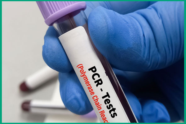 xét nghiệm pcr
