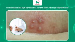 chi phí khám chữa mụn rộp sinh dục hết bao nhiêu