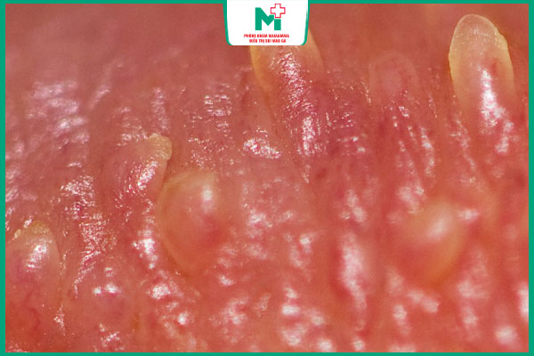 chuỗi hạt ngọc